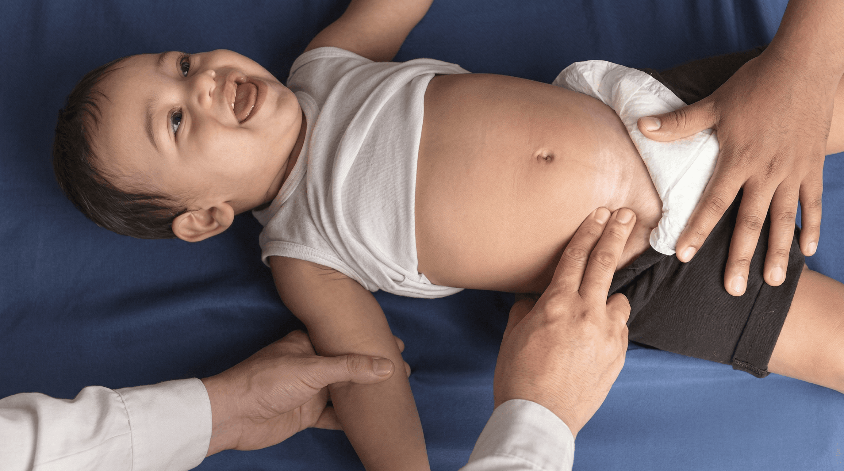 Hernia inguinal en niños: cuándo es momento de operar